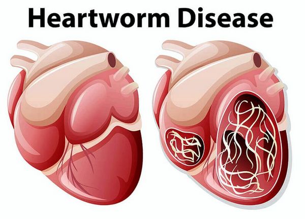 Признаки болезни сердечного червя.