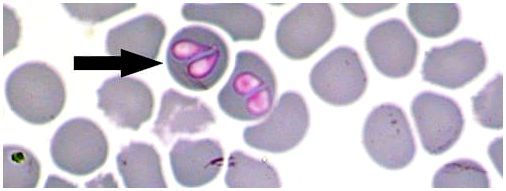 Возбудители пироплазмоза бабезии под микроскопом